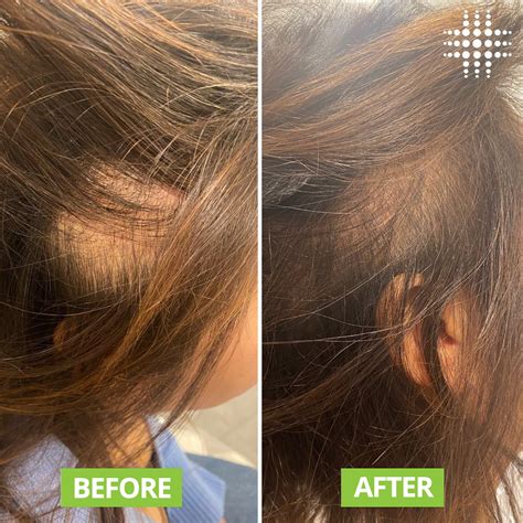Results Laser Clinic (@resultslaserclinic) .